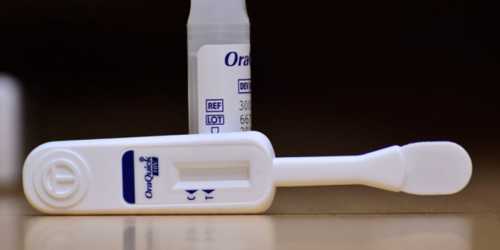 Кропивничанам на гостям міста пропонують безплатні тести на ВІЛ - INFBusiness