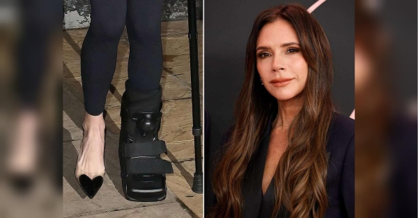 Девід Бекхем підтвердив, що його дружина Вікторія зламала ногу - INFBusiness