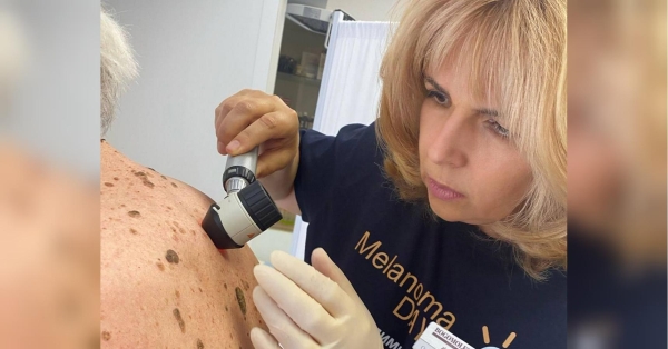«А якщо це меланома? Підозрілу родимку треба терміново показати лікарю, щоб запобігти метастазам і врятувати життя», — Ольга Богомолець - INFBusiness