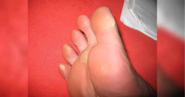 Нове взуття залишає мозолі: чотири способи цього уникнути - INFBusiness