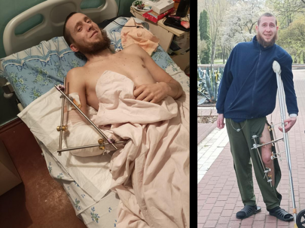 «Мене ніс російський полонений, я жер сніг, немов божевільний»: ветеран про поранення, бізнес і боротьбу - INFBusiness