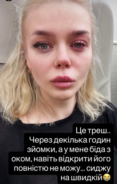 «Це капець»: популярній співачці довелося викликати «швидку» (фото) - INFBusiness