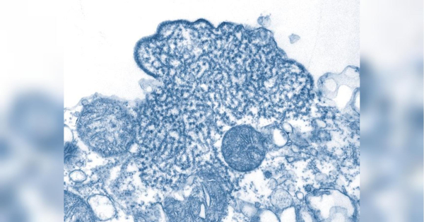 Вірус із високою смертністю поширюється світом: головне про небезпечну хворобу - INFBusiness