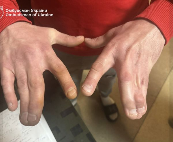 Їли з однієї тарілки: Лубінець шокував результатами перевірки ТЦК в Ужгороді (фото, відео) - INFBusiness