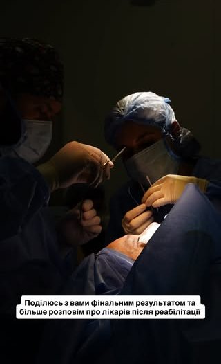 Ектор ліг під ніж хірурга: суддя «МайстерШефа» пояснив, чому зважився на пластику обличчя - INFBusiness