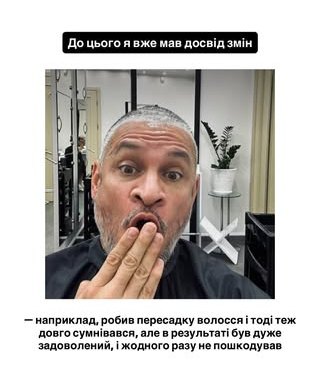Ектор ліг під ніж хірурга: суддя «МайстерШефа» пояснив, чому зважився на пластику обличчя - INFBusiness