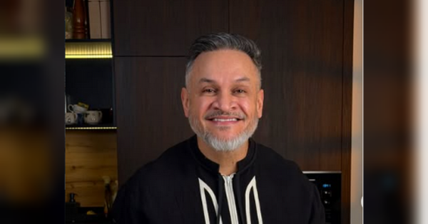 Ектор ліг під ніж хірурга: суддя «МайстерШефа» пояснив, чому зважився на пластику обличчя - INFBusiness