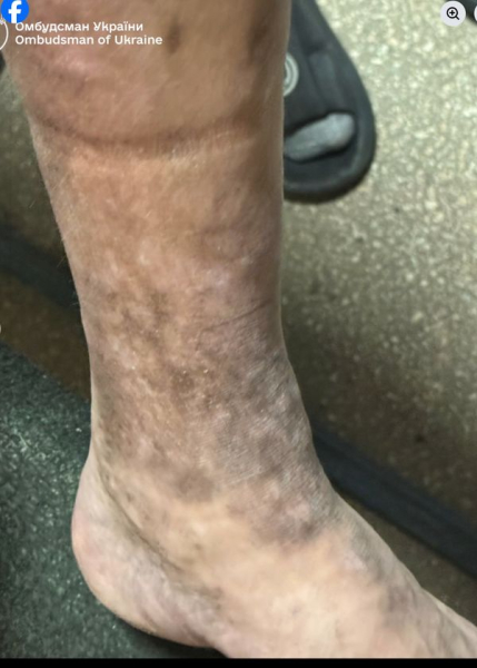 Їли з однієї тарілки: Лубінець шокував результатами перевірки ТЦК в Ужгороді (фото, відео) - INFBusiness