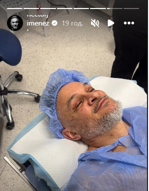 Ектор ліг під ніж хірурга: суддя «МайстерШефа» пояснив, чому зважився на пластику обличчя - INFBusiness