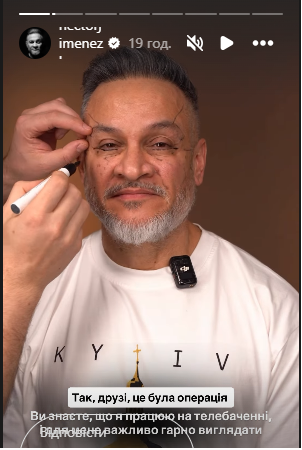 Ектор ліг під ніж хірурга: суддя «МайстерШефа» пояснив, чому зважився на пластику обличчя - INFBusiness